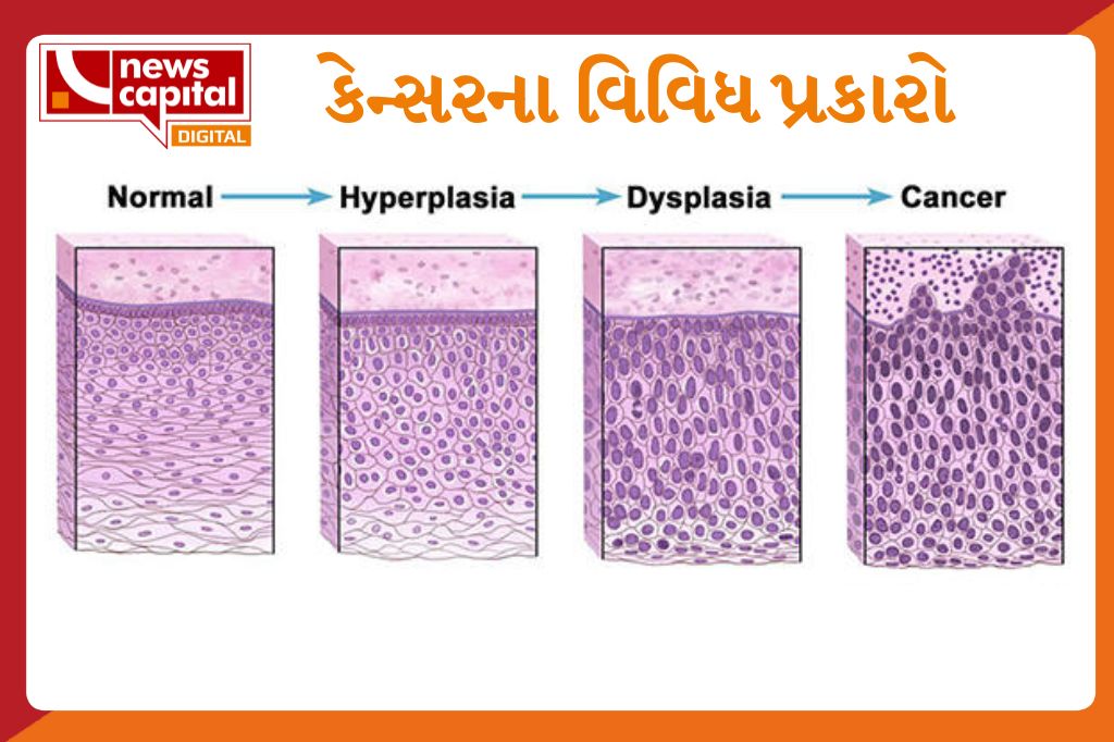 different types of cancer with all details